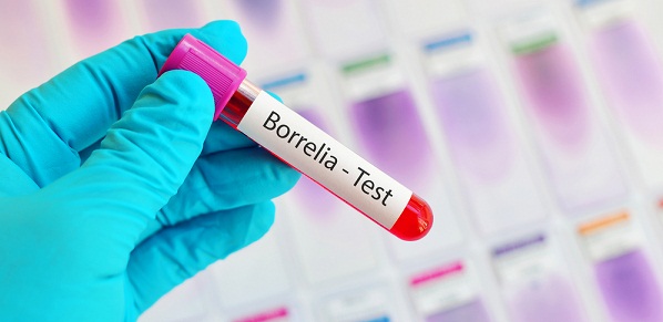 Borrelioza