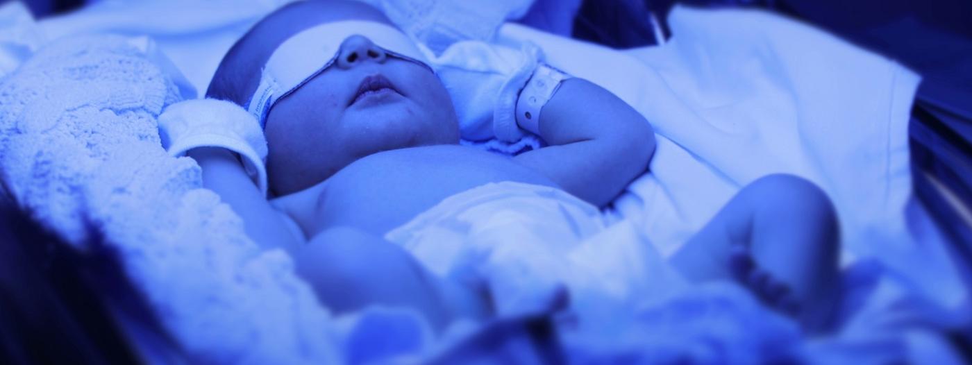 Anti Kell hemolytická žloutenka novorozenců