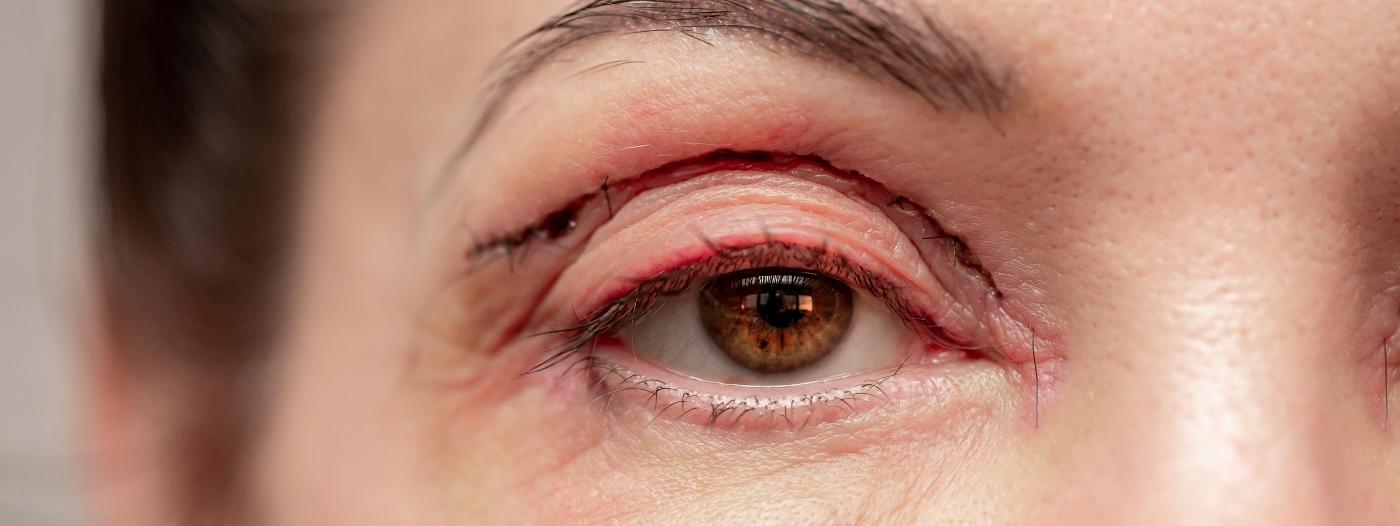 Kosmetické zákroky: Kde končí estetika a začíná zdraví