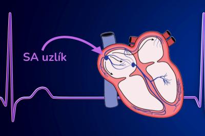 SA uzlík