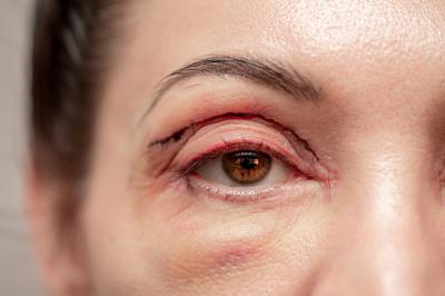 Kosmetické zákroky: Kde končí estetika a začíná zdraví