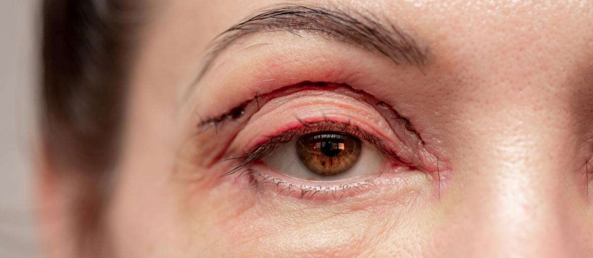 Kosmetické zákroky: Kde končí estetika a začíná zdraví