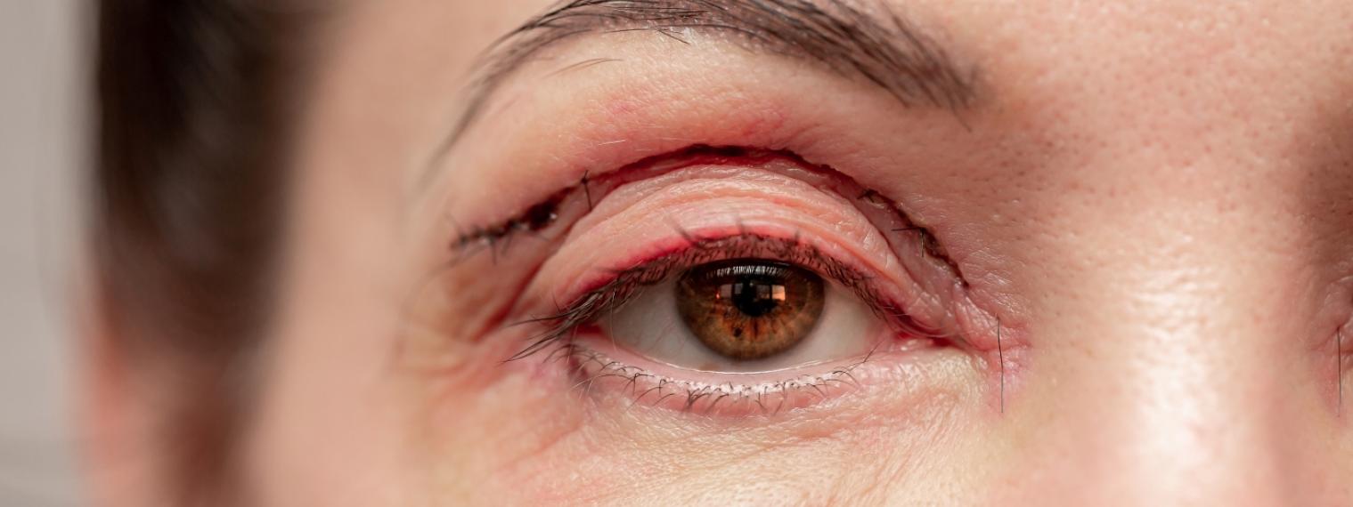 Kosmetické zákroky: Kde končí estetika a začíná zdraví