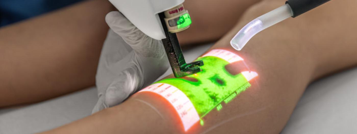 prevence žilní trombózy