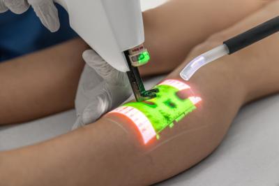 prevence žilní trombózy